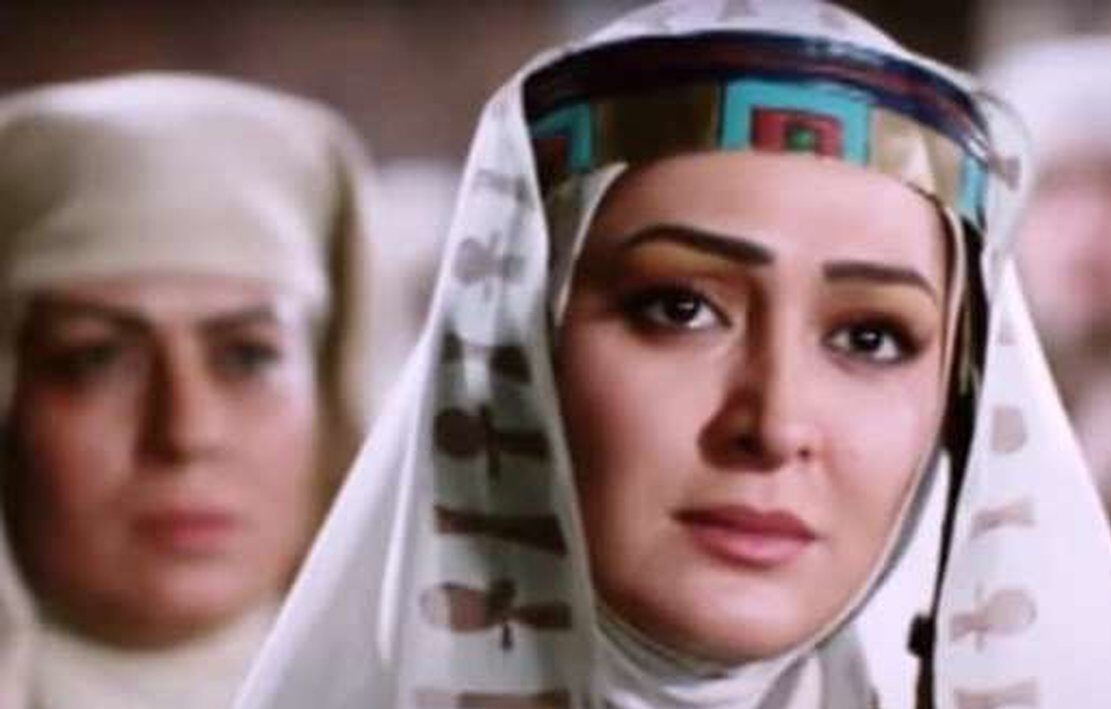 چهره مصنوعی الهام حمیدی بعد از عجیب ترین عمل زیبایی جهان + عکس های هوش پران