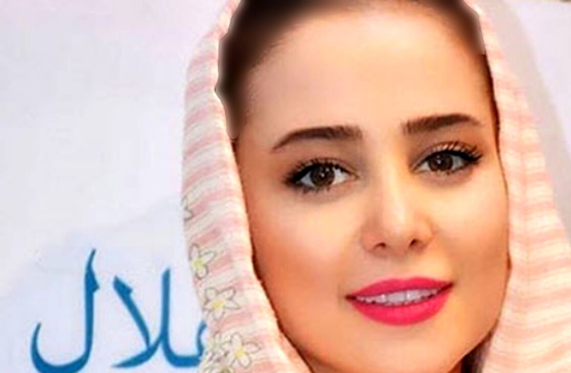 فیلم تغییر چهره فوق دردناک الناز حبیبی/ دختر کوچولوی سینما به چه روزی افتاد؟!