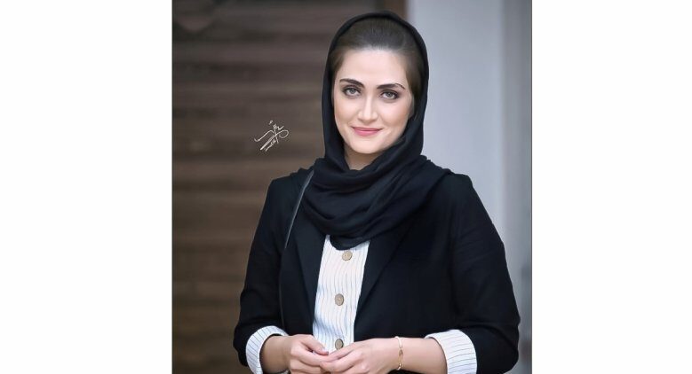 تصاویر جدید از الناز ملک پور خانم چشم رنگی جذاب زخم کاری + عکس