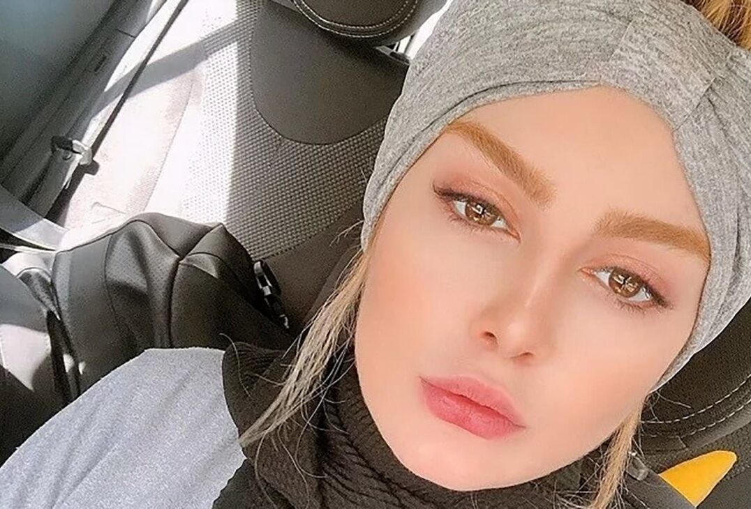 تتوی صورت سحر قریشی چه شد ؟ + عکس تغییر چهره شوکه کننده خانم بازیگر !