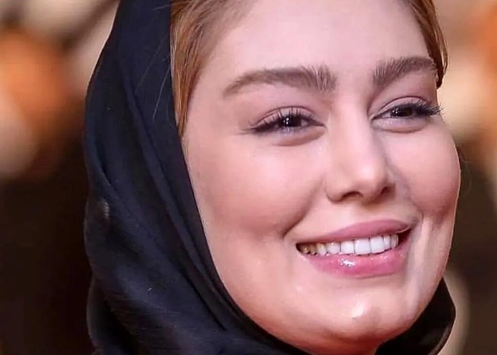 عکس لو رفته زایمان سحر قریشی در بیمارستان / این بچه کیست؟