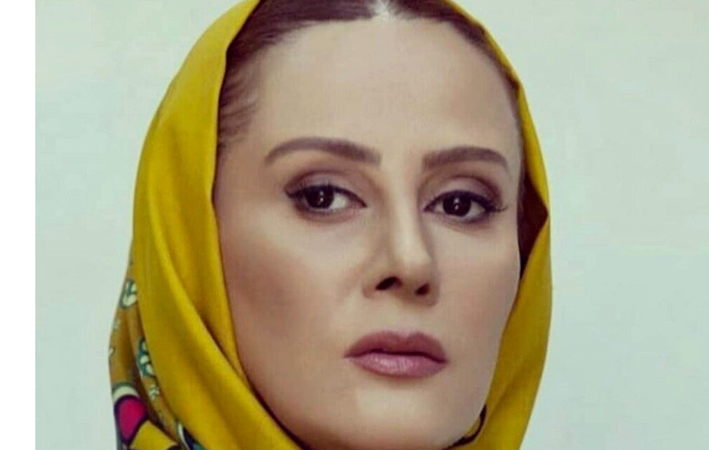 از تغییرات این خانم بازیگر ایرانی حیرت می کنید ! / شیوا خسرو مهر با عمل زیبایی جنیفر لوپز شد !