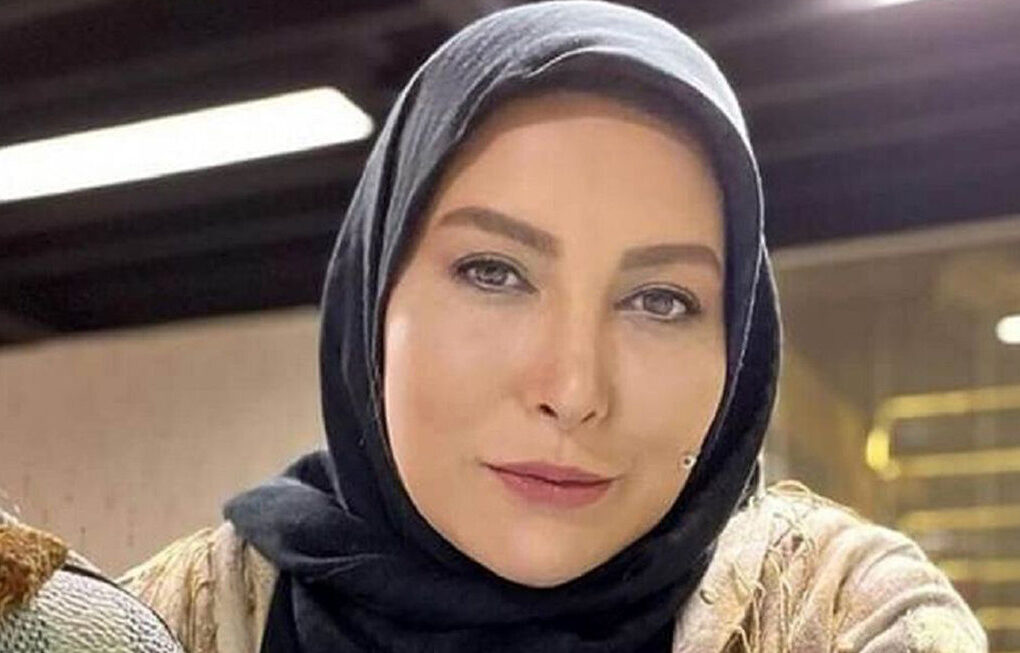 زیبایی فریبا نادری بعد از آخرین عمل جراحی پلاستیک ! / خانم بازیگر ستایش رخ نمایی کرد !