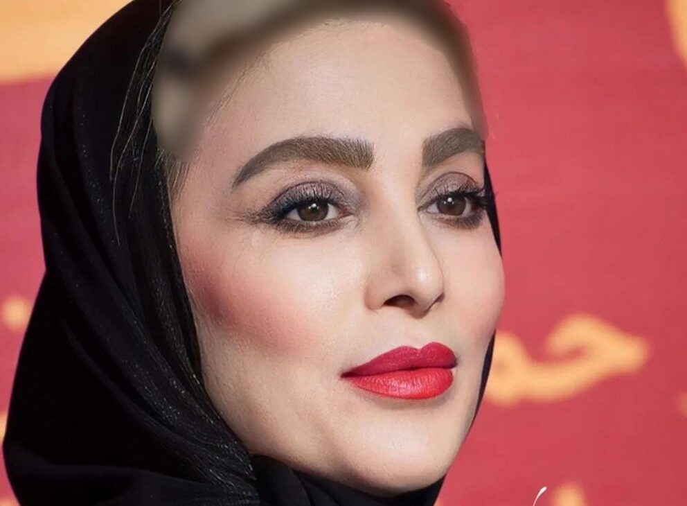 چهره باورنکردنی ژیلا صادقی بعد از 25 سال + عکس قبل عمل زیبایی!