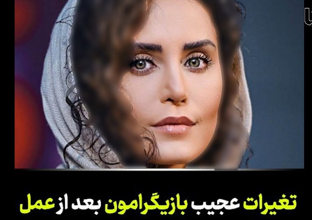 این خانم بازیگران ایرانی با جراحی ملکه زیبایی شدند ! / فیلم تغییرات بازیگران زن !
