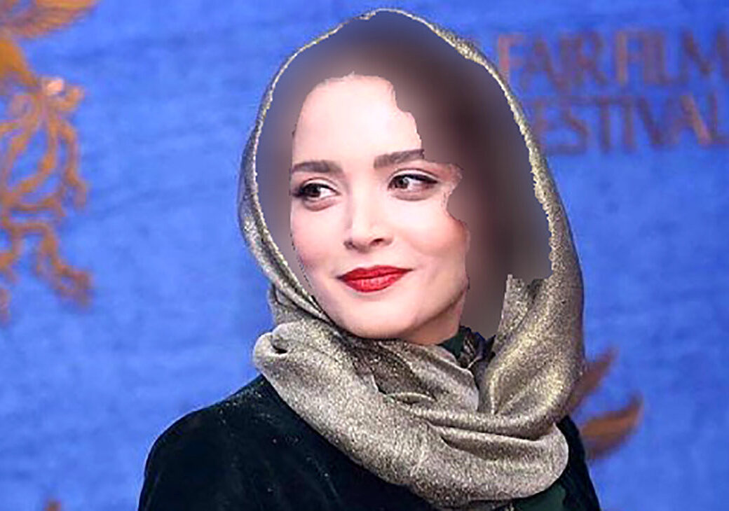 چهره کره ای بهنوش طباطبایی بعد از عمل های زیبایی ! + عکس ها را مقایسه کنید !