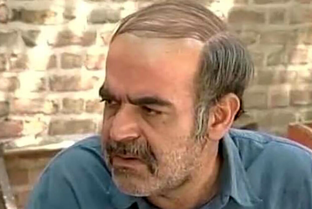 عکس لو رفته از حمید لولایی جهان سریال ترش و شیرین زمانی که کچل بود !