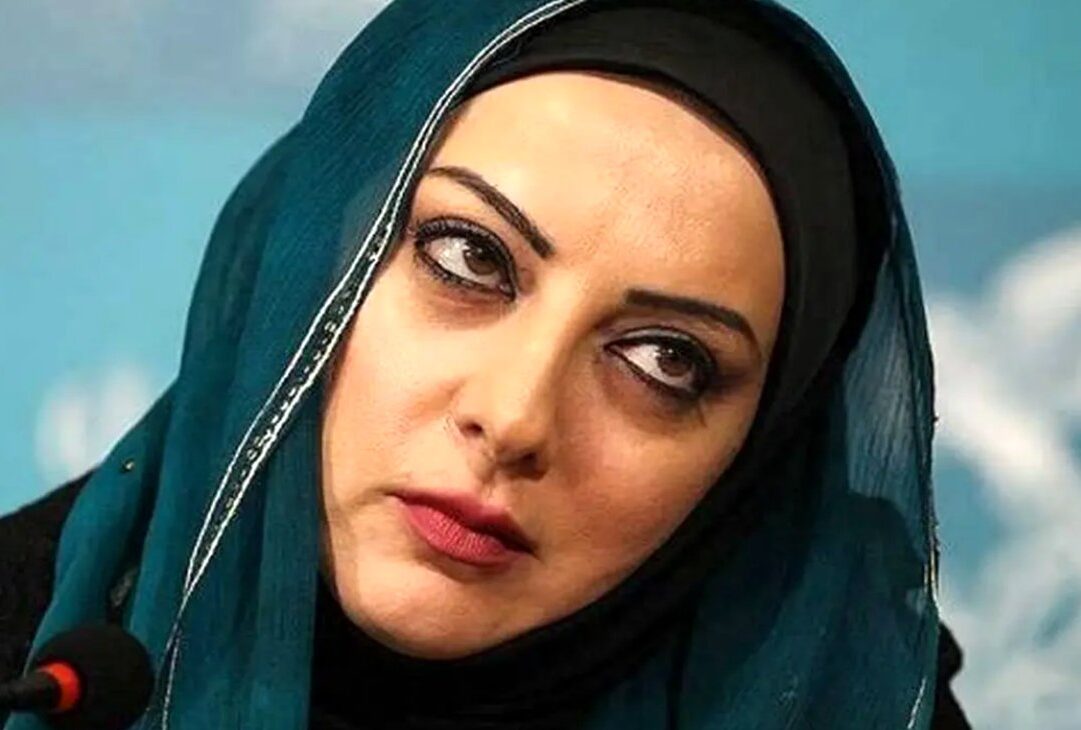 تغییر چهره معکوس حمیرا ریاضی / چه بلایی سر صورت خانم بازیگر زیبا آمد ؟! + عکس قبل و بعد پیری !