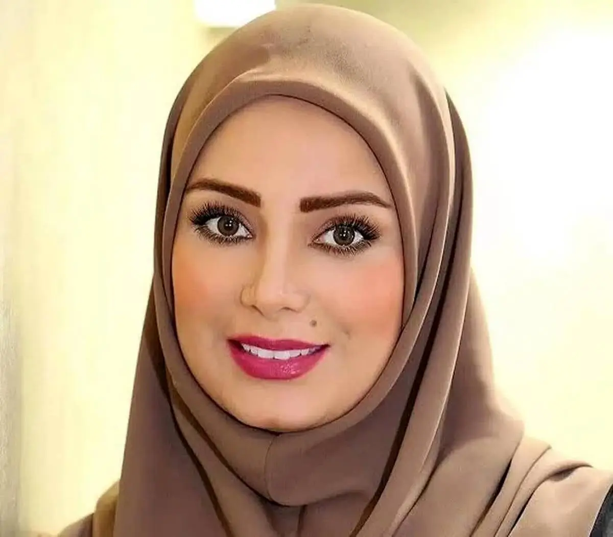 تغییرات چهره مجری جنجالی صدا و سیما / صبا راد را دیگر نمی شناسید