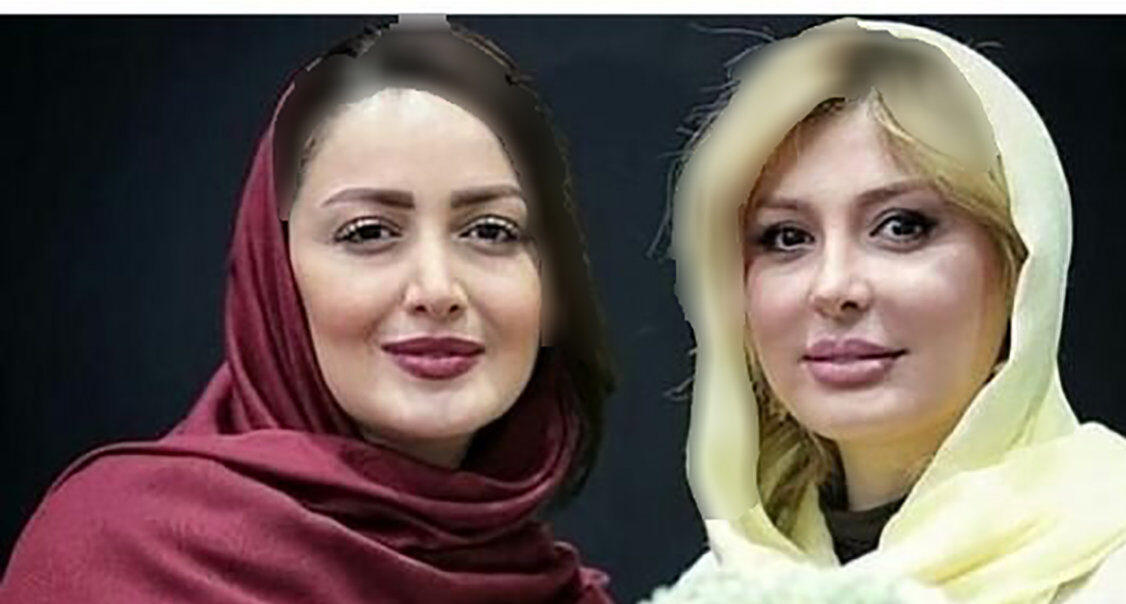 عکس / عمل های زیبایی بی پایان نیوشا ضیغمی / شیلا خداداد راست گفته بود!