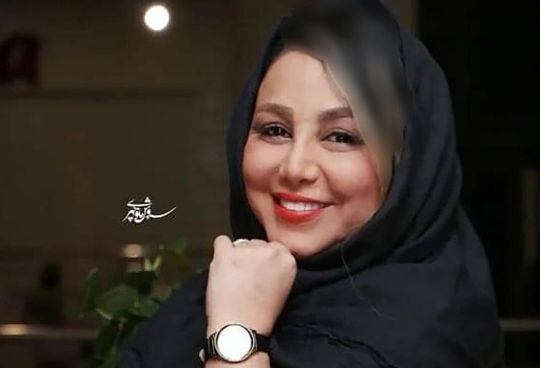 عکس لورفته بهنوش بختیاری زمانی که کراش همه بود ! / قبل و بعد از جراحی زیبایی !
