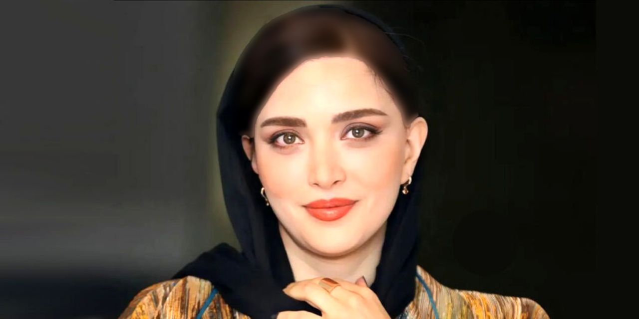 تغییر چهره جذاب بهنوش طباطبایی با عمل های جدیدتر! / گربه بازی خانم بازیگر!