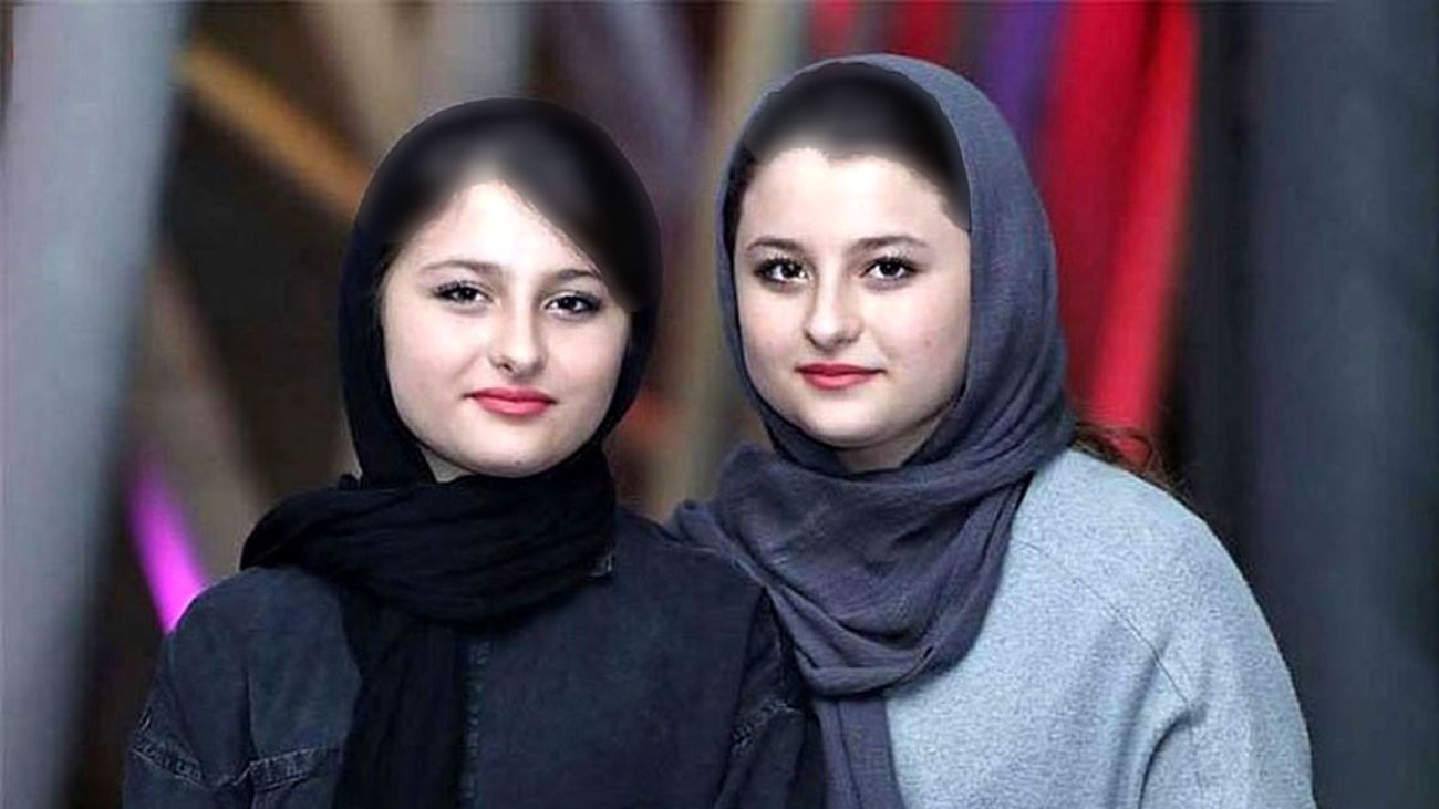 چهره نیکای سریال پایتخت در 20 سالگی / پر از ژل و تزریق !