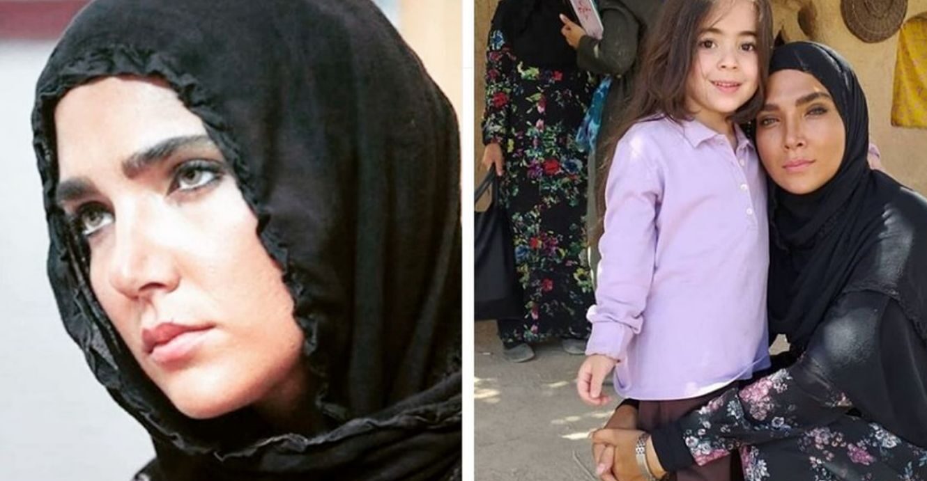 تغییر چهره جالب و چشم نواز «سارا رسول زاده» در 35 سالگی / چاقی صورت یا تزریق؟!